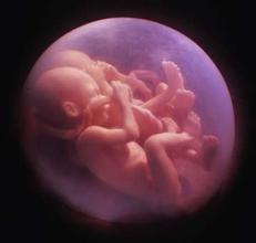 BJOG：多囊卵巢<font color="red">综合征</font>（PCOS）患者双<font color="red">胎</font>妊娠时早产儿风险增加