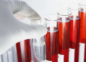 PLOS ONE：新型血液测试快速<font color="red">诊断</font><font color="red">细菌</font>病毒 可少吃消炎药