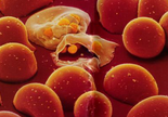 Lancet Haematology：<font color="red">儿童</font>红细胞性状与疟疾风险相关