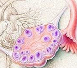 PANS：多囊卵巢综合征内雄激素受体的可变剪接