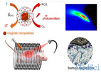 ACS Nano：磁性颗粒加入新型抗癌疗法
