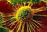 Sci Transl Med：基于免疫治疗的抗癌药物新消息