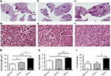 Cell Death&Differ：详解肺癌重要负向调节分子—caspase-2