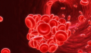 NEJM：输血时红细胞越新鲜越好吗？