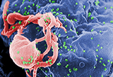 Nature：人体HIV免疫疗法治疗首获成功