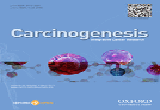 Carcinogenesis：新加坡科研人员揭示中药阿可拉定或可成为耐药性<font color="red">前列腺癌</font>新疗法