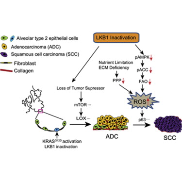 Cancer Cell：LKB1<font color="red">失</font>活调控非小细胞肺癌可塑性和药物反应机制