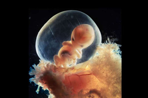 胎儿在妈妈肚子里做什么呢？ 