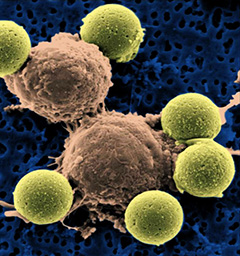肿瘤细胞免疫治疗时代到来的机遇与挑战