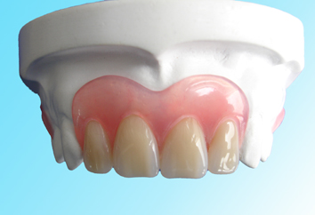 J Oral Rehabil：口腔功能的恢复——可摘<font color="red">义齿</font>仍是一个选择