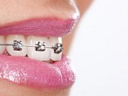 <font color="red">BMC</font> Oral Health：矫正牙齿可以改变牙齿的颜色？