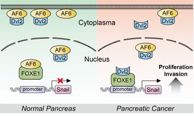 Nat Commun：极性蛋白AF6可能抑制胰腺癌转移