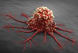 科学家发现癌症转移细胞学机制:扩散是转移开始