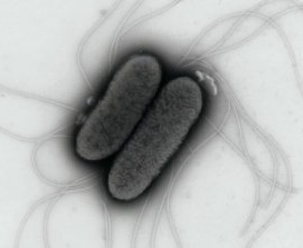 PLoS ONE：沙门氏菌引发感染的分子机制