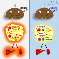 Cell Metab：靶向作用炎症有效<font color="red">抵御</font>肥胖疾病