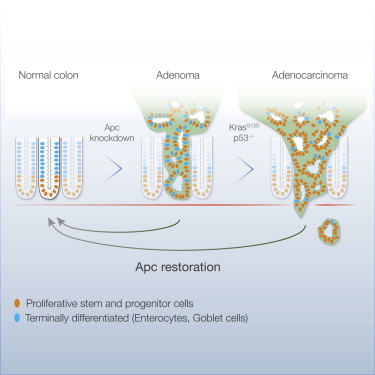 Cell：哇！单基因可逆转结肠癌 重建正常组织功能