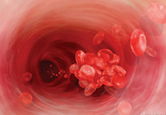 NEJM：静脉血栓栓塞患者的<font color="red">隐匿</font>性癌症筛查
