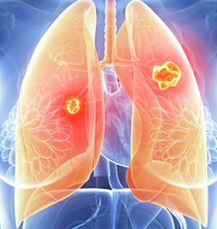 PNAS：携带siRNA纳米颗粒可抑制肺癌细胞