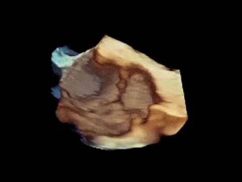 4D超声技术引领彩超行业变革 影像清晰逼真 可见胎儿表情