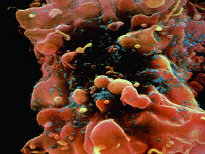 PNAS：既能抗癌又能抑制艾滋病的小分子