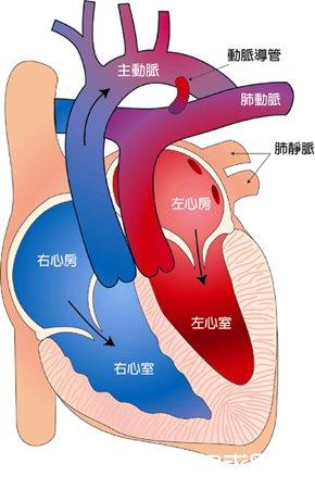 动脉“长反了” 出生仅3天<font color="red">的</font>宝宝做“心脏整形”