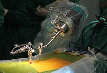 国产机器人完成外科最复杂手术：世界首例