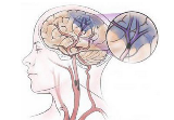 J Neurol：血糖控制对脑缺血患者<font color="red">静脉</font><font color="red">溶</font><font color="red">栓</font>治疗预后的影响