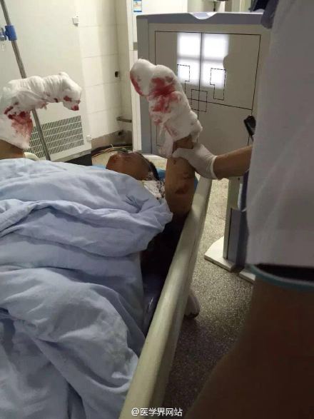 安徽医生遭男子自制爆炸物炸伤