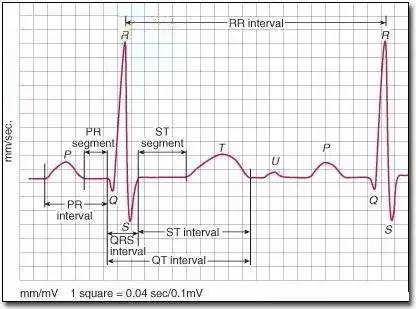 10种心电图,1句话牢记!