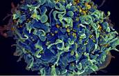 Nat Immunol：HIV的致命弱点