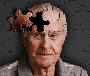 真的已经找阿尔兹海默症可以传播的新证据了？