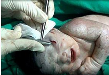 战火中的奇迹：医生剖腹产救下“弹片婴儿”（组图）