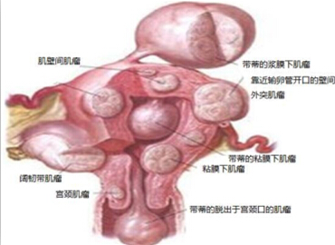 “大姨妈”量过多<font color="red">致贫</font>血，老师上课时晕倒讲台