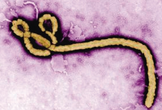 NEJM：知道埃博拉病毒RNA可在幸存者<font color="red">精液</font>中存活多久嘛？！