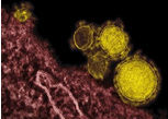 NEJM：埃博拉病毒性传播案例及启示