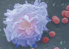 science：防止肺癌转移？白细胞亚群保驾护航