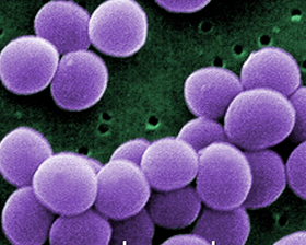 <font color="red">PNAS</font>：抵御耐药性细菌感染的重大突破