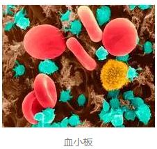 Cancer cell：基于肿瘤血小板的<font color="red">RNA</font>测序精准诊断肿瘤新方法