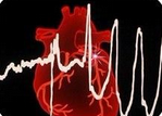 Int J Cardiol：<font color="red">外</font>周动脉疾病和<font color="red">房颤</font>是卒中、心衰及<font color="red">心血管</font>死亡的独立危险因素