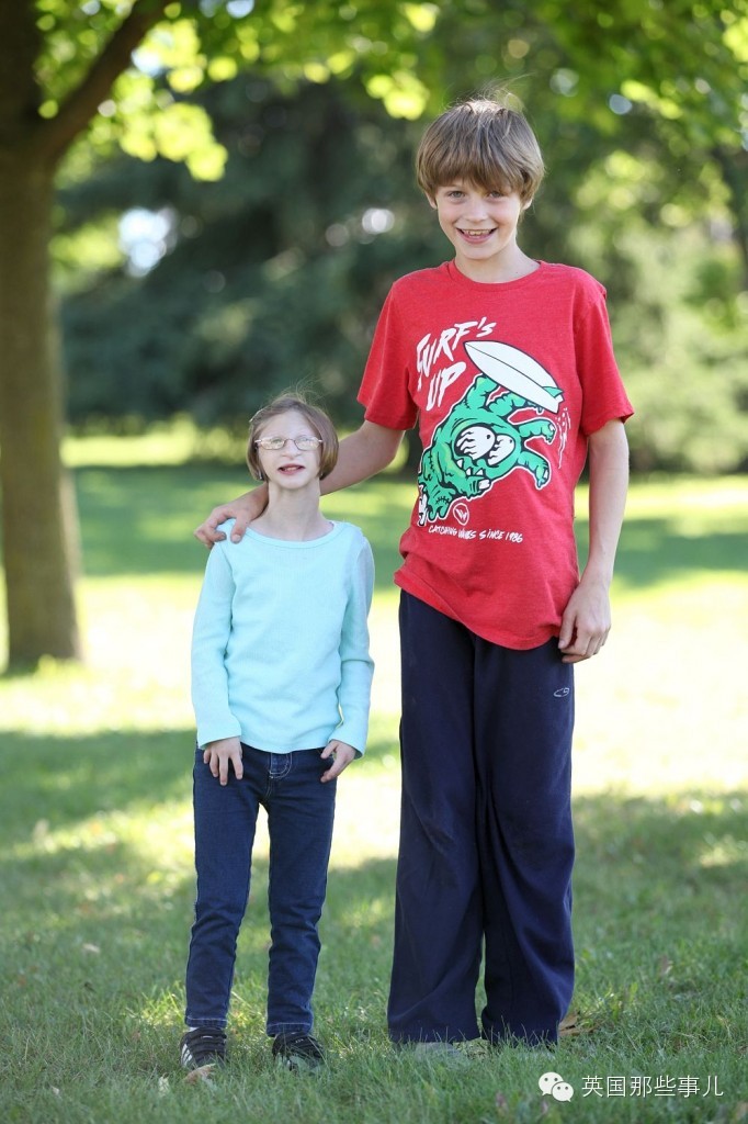 可能是世界上身体最小的"拇指姑娘".