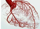 BMJ：治疗冠状动脉支架内再狭窄效果最好的方式是什么？（网状Meta）