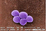Cell Host & Microbe：<font color="red">抗生素</font>治疗<font color="red">超级</font>细菌MRSA会导致感染加剧！！！