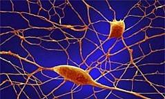 Lancet Neurol：淀粉样蛋白和神经退行性变影像学表现随年龄动态变化