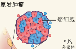 Nature：外泌体决定肿瘤<font color="red">转移</font>的<font color="red">器官</font><font color="red">特异性</font>