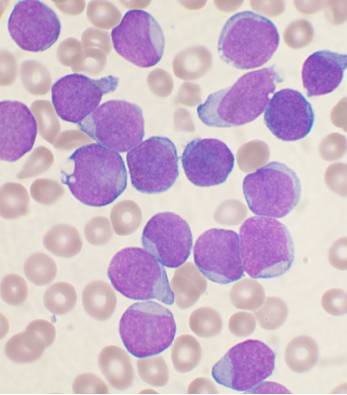 PNAS：砷剂治疗白血病主要与抑制糖酵解的<font color="red">代谢</font><font color="red">途径</font>有关
