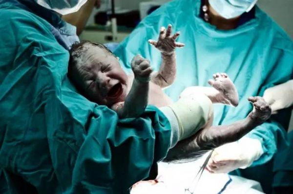 关于周末分娩新生儿围产期死亡率高的原因研究及结果讨论