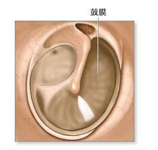 鼓膜修复术-正常解剖（图片）