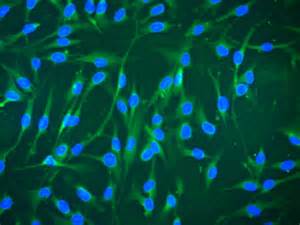 Lancet Haematol：间充质干细胞治疗改善激素耐药的急性GVHD患者生存