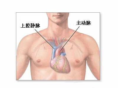 心脏移植术-正常<font color="red">解剖</font>、手术适应症、手术过程和手术预后（图片）