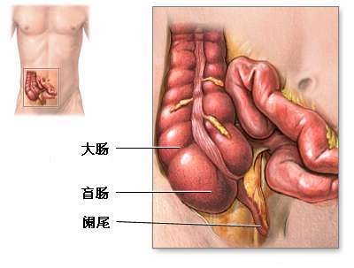阑尾切除术-正常解剖、手术适应症、手术切口、手术过程和手术预后（图片）